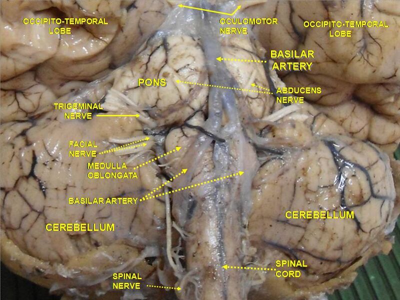 File:Slide3PIT.JPG