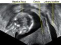 Thumbnail for version as of 22:28, 8 June 2026