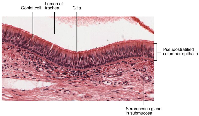 File:2304 Pseudostratified Epithelium.jpg