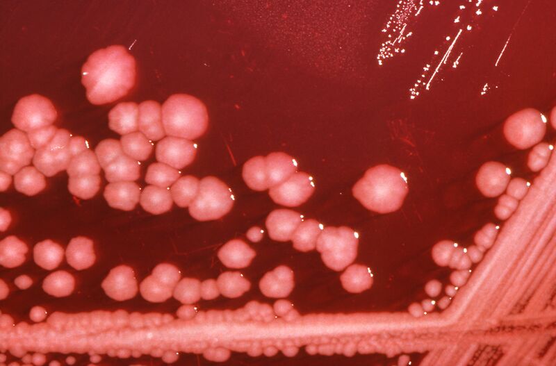 File:Proteus mirabilis 01.jpg
