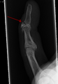 Thumbnail for version as of 03:35, 5 June 2026