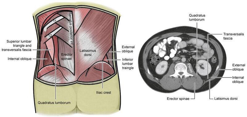 File:LumbarTriangle.jpg