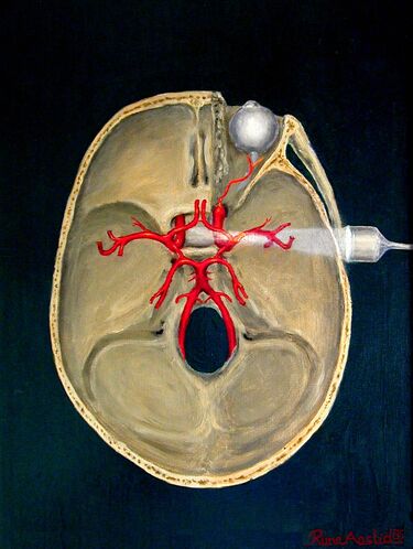 File:Transcranial doppler.jpg