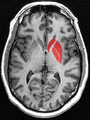 Thumbnail for version as of 12:52, 29 May 2026