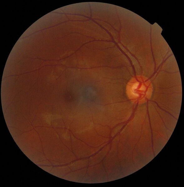 File:Retinography.jpg