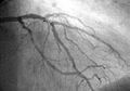 Cardiac imaging
