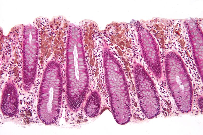 File:Melanosis coli intermed mag.jpg
