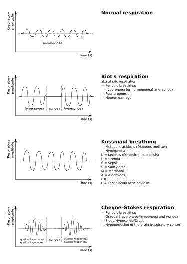 File:Breathing abnormalities.svg