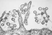 Transmission electron micrograph of the Sin Nombre Hantavirus