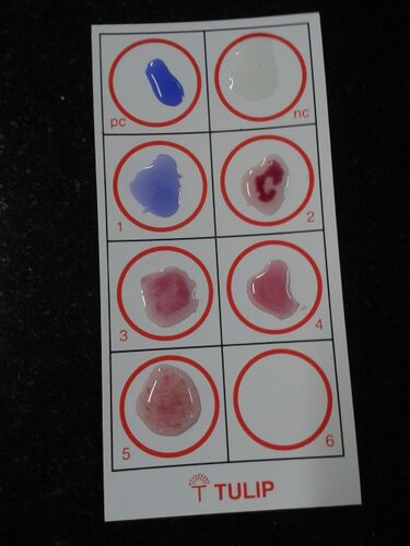 File:Widal Test Slide.jpg