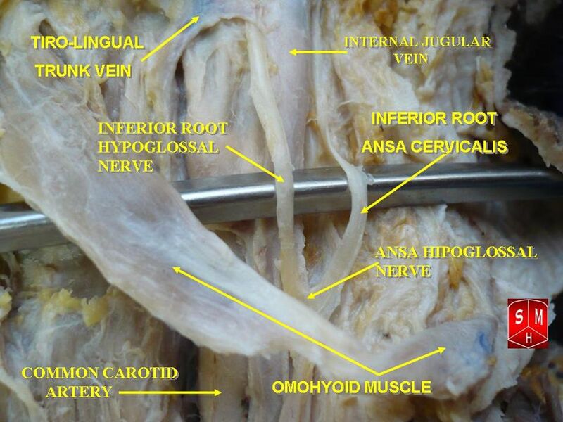 File:Ansa cervicalis.jpg