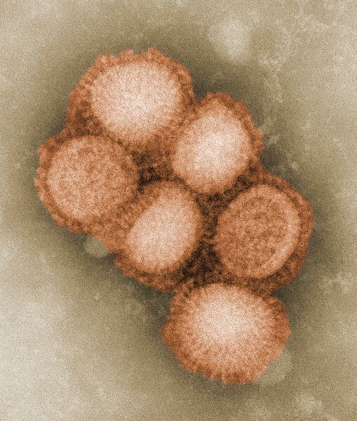File:CDC-11214-swine-flu.jpg