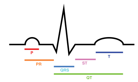 File:ECG Intervals.svg
