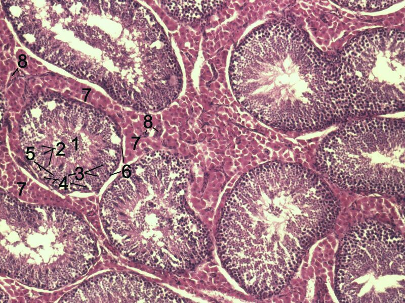 File:Testicle-histology-boar.jpg