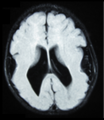Thumbnail for version as of 03:32, 5 June 2026
