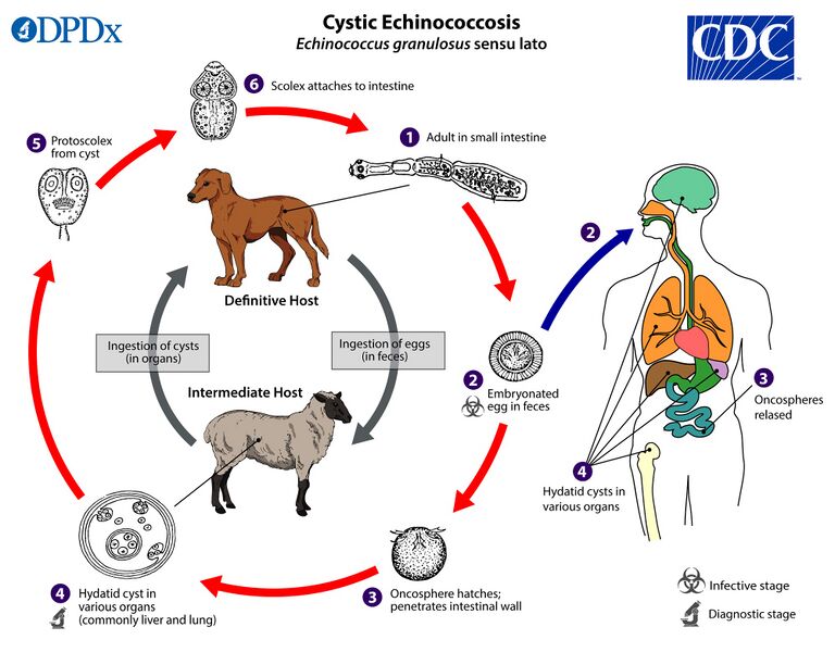 File:Echinococcus gran LifeCycle lg.jpg