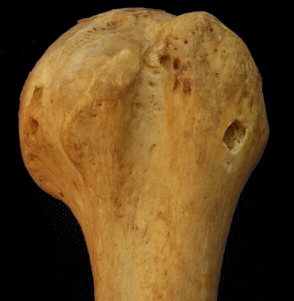 File:AnteriorHeadOfLeftHumerus.jpg