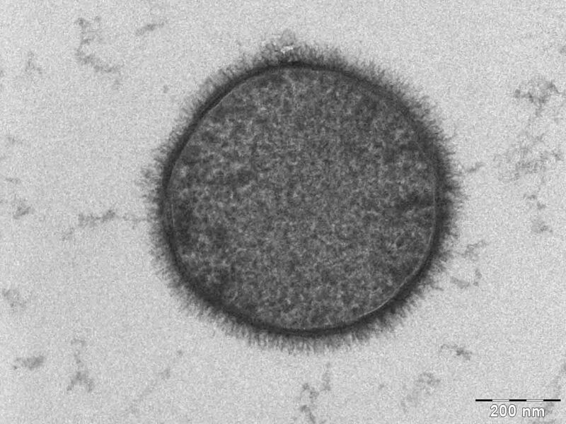 File:Bacillus subtilis.jpg