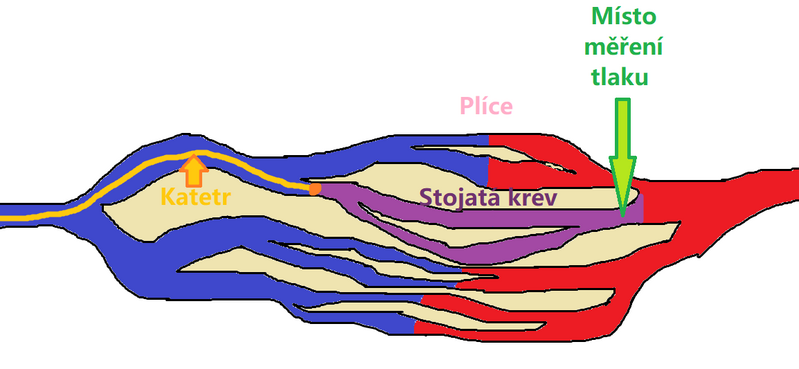 File:Měření tlaku v zaklínění.png
