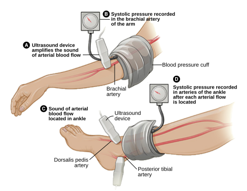 File:Pad abi ENG.svg