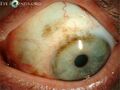 Thumbnail for version as of 03:20, 5 June 2026