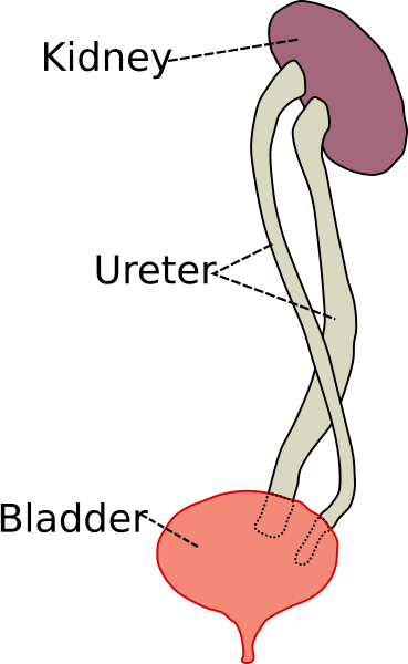 File:Duplicated ureter.svg