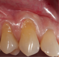 Thumbnail for version as of 03:29, 5 June 2026
