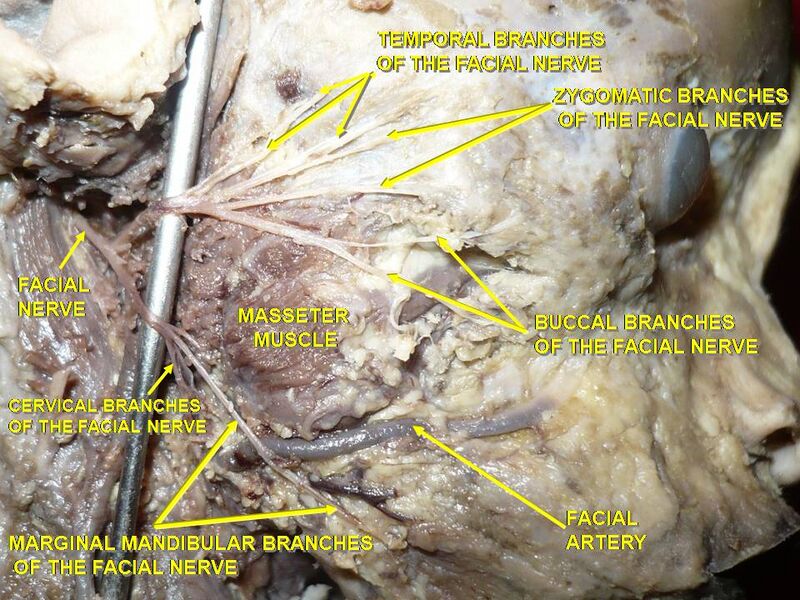File:Slide1BAB.JPG