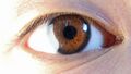 Human eye with limbal ring, anterior view