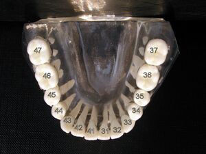 ISO notation lower jaw