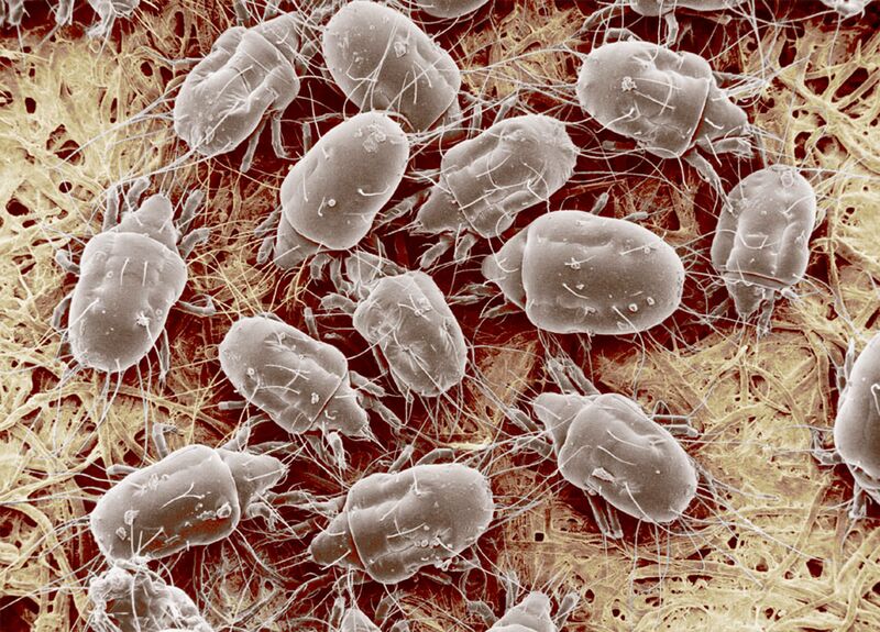 File:Cheese mite.jpg
