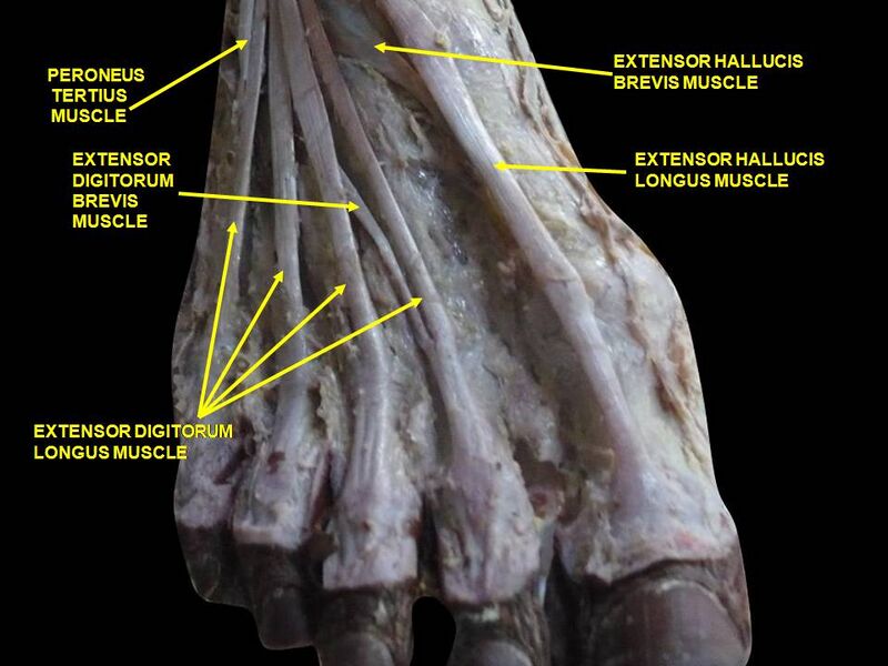 File:Slide1ABBAA.JPG