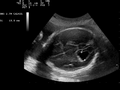 Thumbnail for version as of 03:25, 5 June 2026
