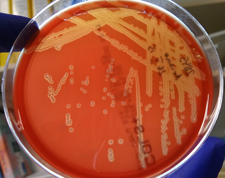 File:Arcanobacterium haemolyticum after 48 hours.jpg