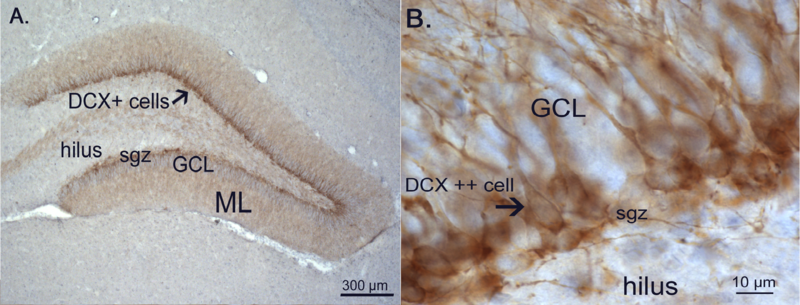 File:Doublecortin expression-2.png