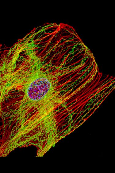 File:Fluorescent image fibroblast.jpg