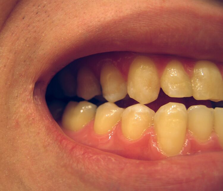 File:Cusp tips.JPG