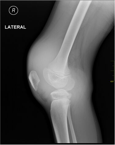 File:Medical X-Ray imaging JDG05 nevit.jpg