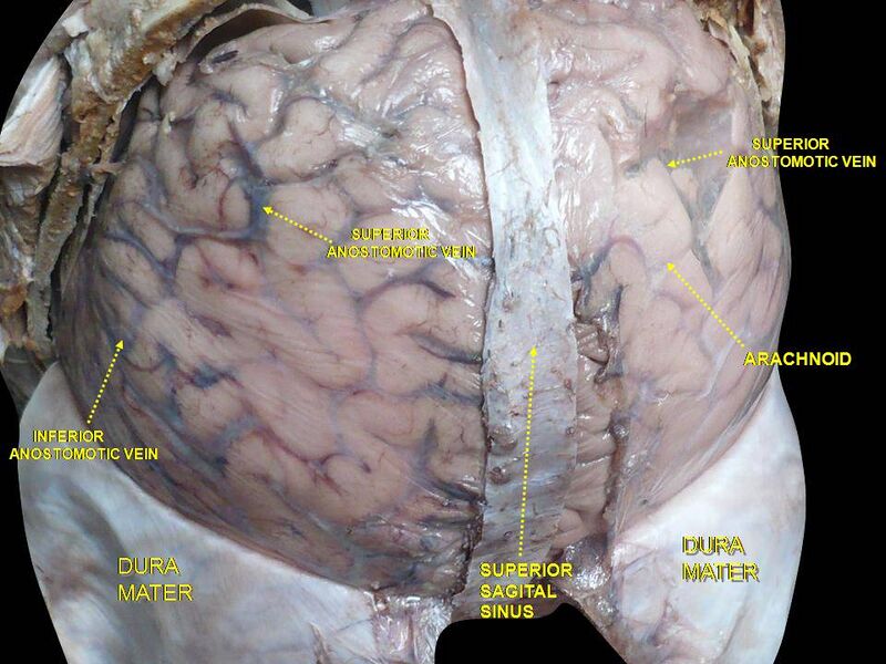 File:Slide7Neo.JPG