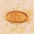 Thumbnail for version as of 03:31, 5 June 2026
