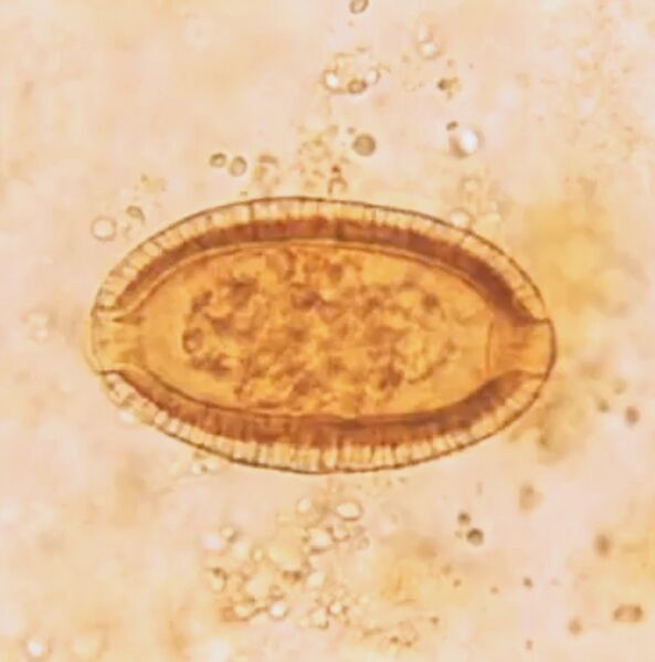 File:CapillariaPhilippEgg.jpg
