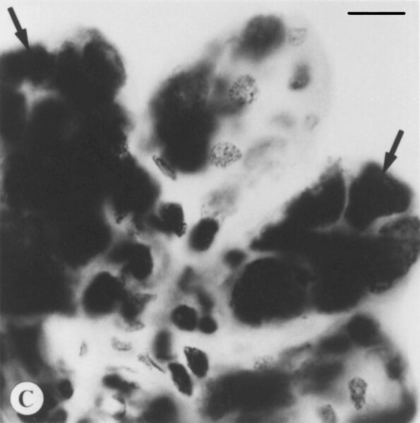 File:Deer tick virus.jpg