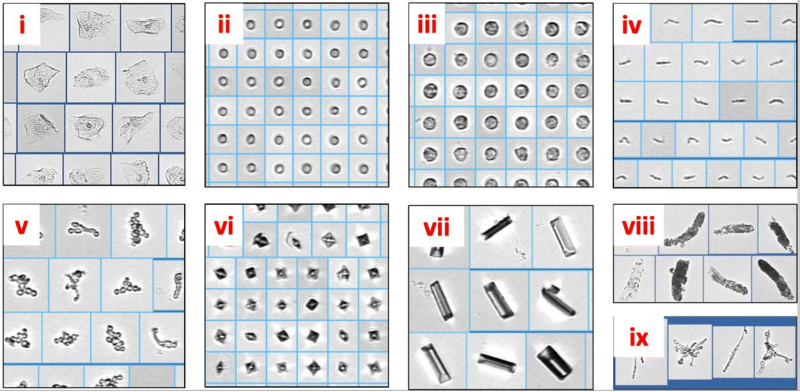 File:Formed elements of urine.png