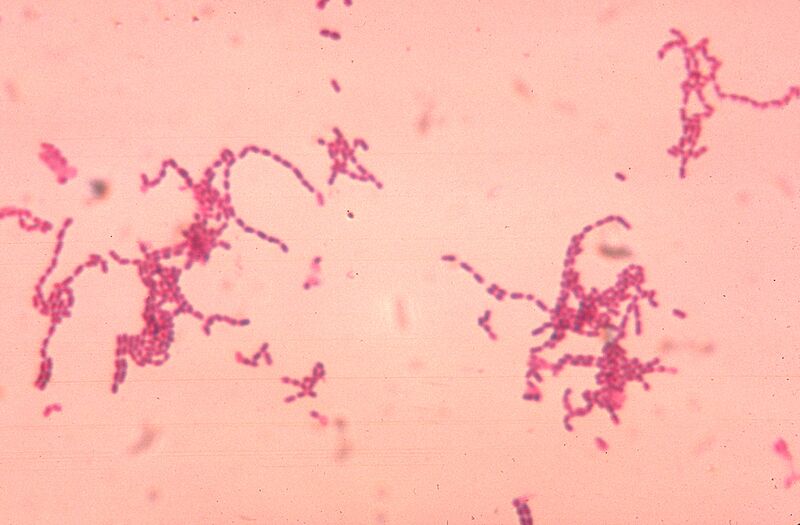 File:Peptostreptococcus spp 01.jpg