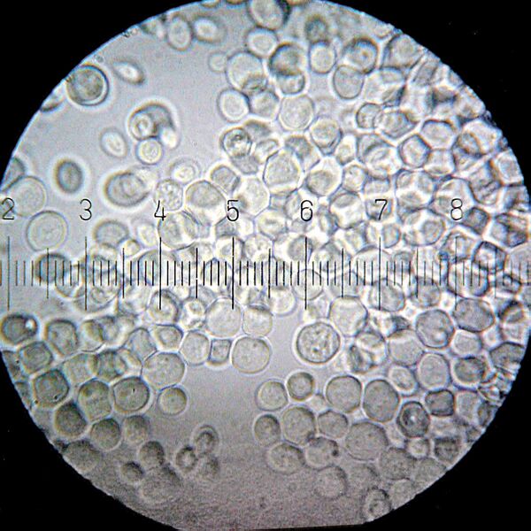 File:20100911 232323 Yeast Live.jpg