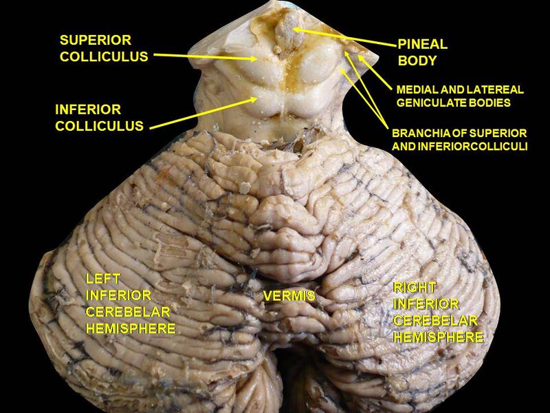File:Slide2BRA.JPG