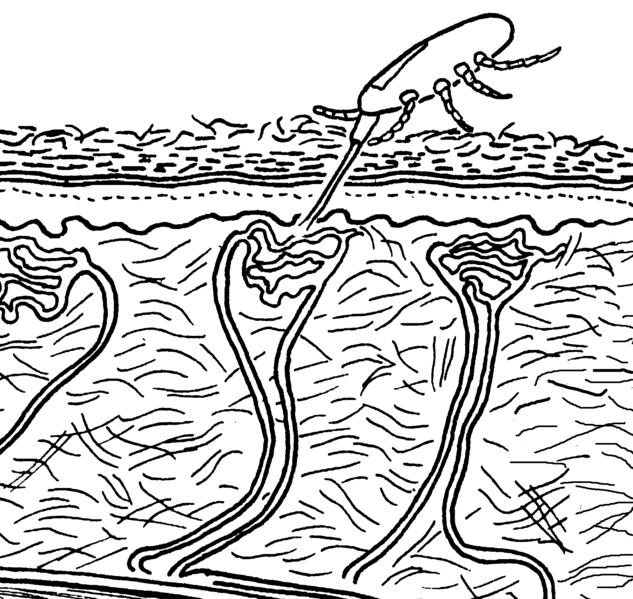 File:Dermanyssus feeding skin.png