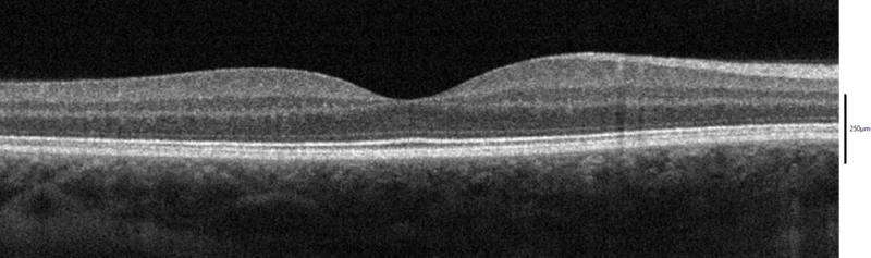 File:SD-OCT Macula Cross-Section.png