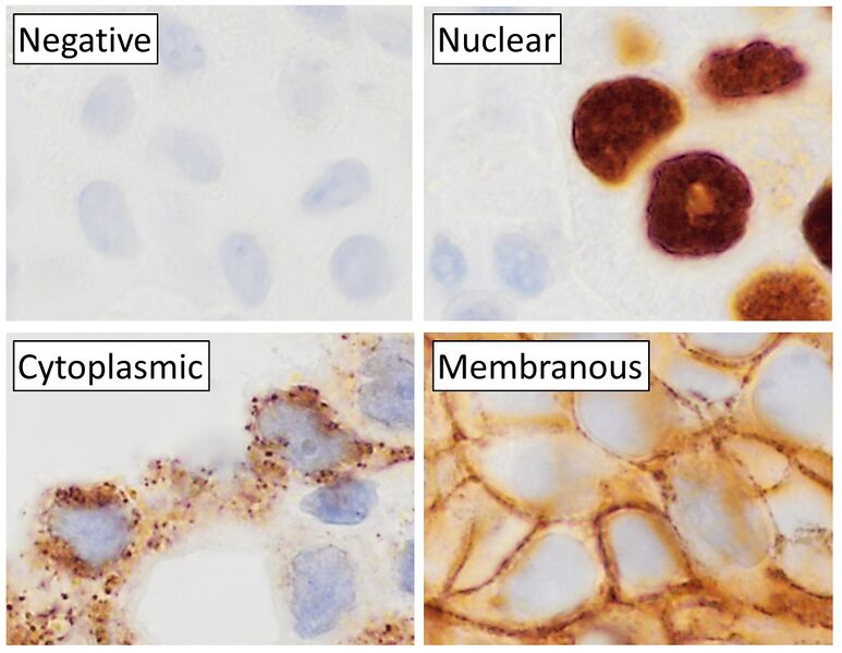 File:Main staining patterns on immunohistochemistry.jpg