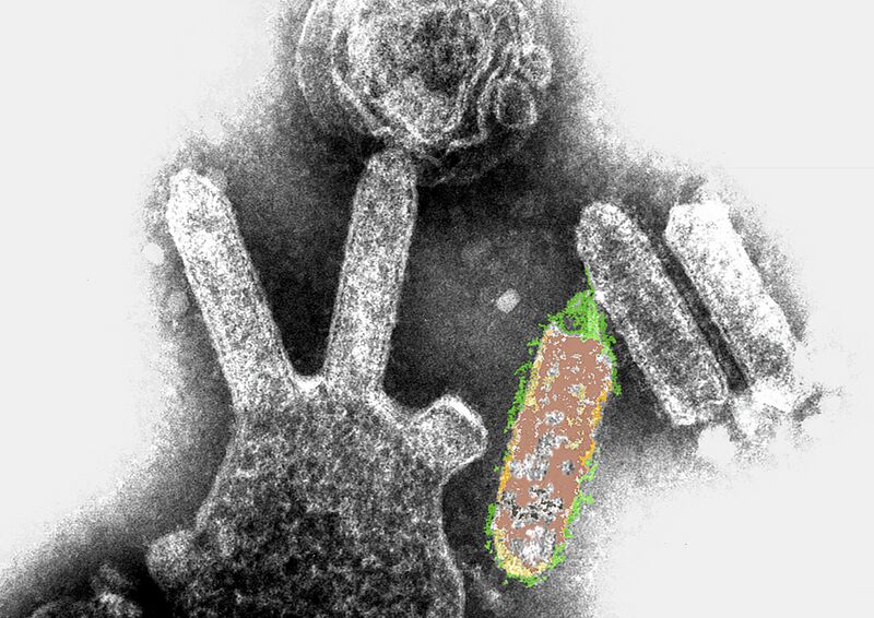 File:CSIRO ScienceImage 1977 Bat Lyssavirus.jpg